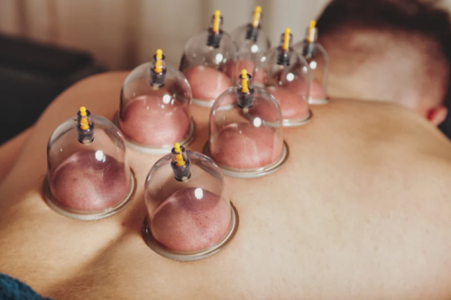 soin du dos aux ventouses - hijama - espace bien-être camille ayurvéda - Limoux